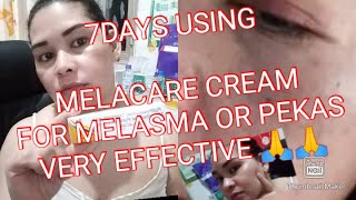 MELACARE CREAM 7DAYS USING EFFECTIVE MELACARE CREAM FOR MELASMA OR PEKAS 🙏🙏LEGIT USER [upl. by Dannie]