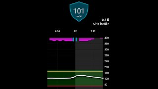 780G İnsülin Pompa Verilerini Nasıl İzleyelim I Carelink Connect Uygulaması [upl. by Jarrow]