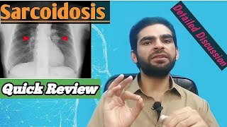 sarcoidosis in urdu hindi  signs amp symptoms investigations treatment [upl. by Theodosia]