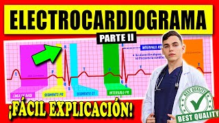 ELECTROCARDIOGRAMA Interpretación  FÁCIL EXPLICACIÓN [upl. by How]