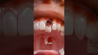 Swallowing a tooth🦷 what happens😬 [upl. by Maryjo]