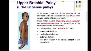 erbs palsy upper limb anatomyfcps part1 preparation forumcpsp favorite BCQUES [upl. by Arramahs]