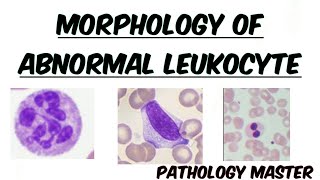 Abnormal Leukocyte Morphology  In Peripheral Blood Smear  Images  Made Easy [upl. by Mauceri]