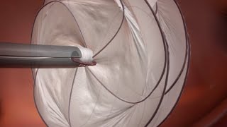 GORE® CARDIOFORM Septal Occluder PFO Animation [upl. by Kciremed]