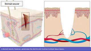 Skin Wound Healing Process [upl. by Valenba597]