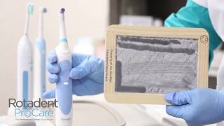 The Rotadent ProCare® Chalkboard Challenge How CLEAN are your teeth [upl. by Nyrat]