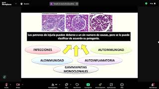 Glomerulopatías primarias  Nefrología  sem 12 [upl. by Onailime]