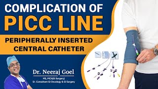 Understanding Complications and Management of Peripherally Inserted Central Catheters PICC line [upl. by Mosi183]