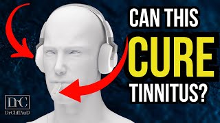 New Tinnitus Treatment Update  Bimodal Neuromodulation from Lenire [upl. by Anairotciv]