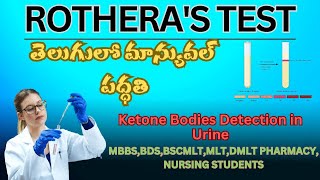 ROTHERAS TEST KETONE BODIES DETECTION IN URINE in telugu manual method [upl. by Lynde381]