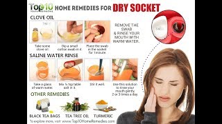 Dry Socket 6 Effective Home Remedies For Dry Socket 6 Natural Cures For Dry Socket [upl. by Charleton]