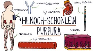 HenochSchonlein Purpura Visual Explanation for Students [upl. by Onyx]