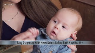 Baby diagnosed with heart defects before birth now healthy [upl. by Cash]