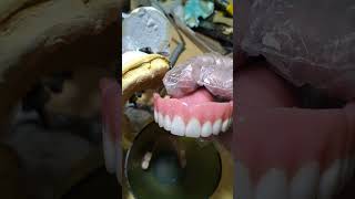 Ivocap Dentures and Flexible Dentures Full Denture and lower denture [upl. by Kisung]