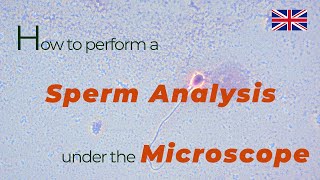 How to perform a sperm analysis under the microscope  urologist göttingen [upl. by Puiia]