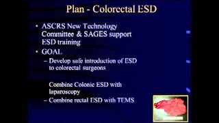 Endoscopic Submucosal with diagnostic Laparoscopy  PG MIS Colorectal Surgery [upl. by Humph]