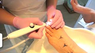 1 Tutorial NAIL MYCOSIS Solution  Imperial Feet Cosmetics [upl. by Justino]