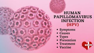 Human papillomavirus infection  HPV  What is HPV amp How do you get it [upl. by Der373]