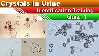 Crystals In Urine Identification Training Quiz  Part 15 [upl. by Platon]