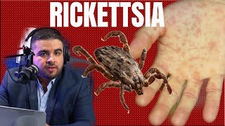 Rickettsiosis o Fiebre Manchada Enfermedad transmitida por Garrapatas [upl. by Trixy]