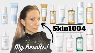 Skin1004 Review amp Whats the Difference Between the Lines [upl. by Coats286]