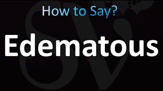 How to Pronounce Edematous correctly [upl. by Titania497]