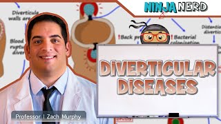 Diverticular Diseases  Clinical Medicine [upl. by Elbag]