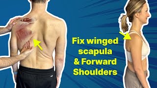 The 1 Exercise to Fix Winged Scapula amp Forward Shoulder  GET OUT of PAIN [upl. by Kcinom]