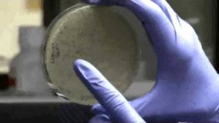 Killing bacteria with viruses for safer food  VOA newscom [upl. by Orel491]