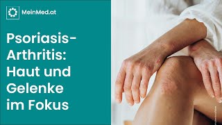 PsoriasisArthritis Entzündete Gelenke bei schuppender Haut [upl. by Nassah]