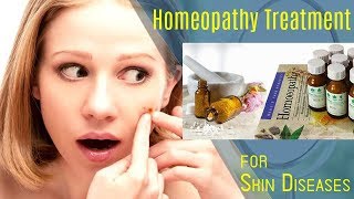 Sulphur for Skin Diseases  Pimples  Homeopathy  Dr Ketan Shah  MD Homeopathic [upl. by Niles]