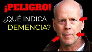 ¡REVELADO Primeras señales de DEMENCIA  PREVENCIÓN y TRATAMIENTO DEMENCIA [upl. by Alessandro]