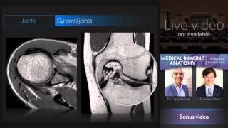 Types of Joints  Medical Imaging Anatomy Course [upl. by Neerom]