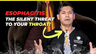 Esophagitis The Silent Threat to Your Throat [upl. by Hoyt]