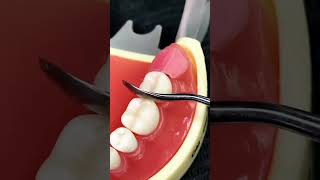 How to fill the gap after removing the corner teeth in the mouth shortvideo newbornbaby dentalcar [upl. by Kaslik394]