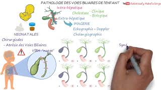 PATHOLOGIE DES VOIES BILIAIRES DE l’ENFANT [upl. by Boothe]