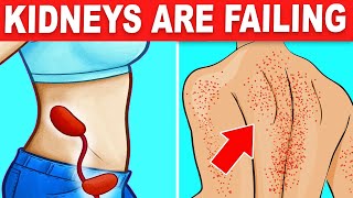 10 Signs Your Kidneys Are Crying For Help [upl. by Eerbua889]