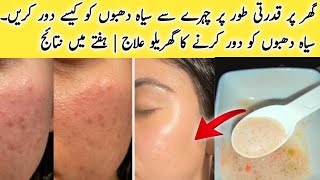 How to Remove Dark Spots from Face Naturally at Home  Home Remedies to Remove Dark Spot [upl. by Spark]