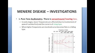 ENT Menieres Disease Part 2 Examination Investigations Diagnosis Staging Ear Check test confirm [upl. by Clarabelle]