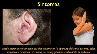 otitis externa ESPANOL [upl. by Cudlip]