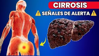 11 Señales Tempranas de Cirrosis Hepática que No Debes Ignorar [upl. by Lenee291]