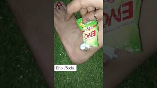 Get Fair Feet In 5minutes  Remove Suntan Easily At HomeGet Rid Of Dark Ankle shorts viralvideo [upl. by Albina]