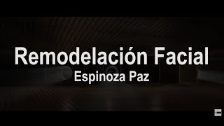 Remodelación Facial Letra  Espinoza Paz [upl. by Nava]