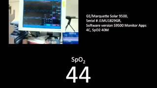 PulseOx 19 GE Solar 9500 SN J1MU1829GR 100to1 [upl. by Willdon]