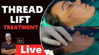 THREAD LIFT TREATMENT [upl. by Inger500]