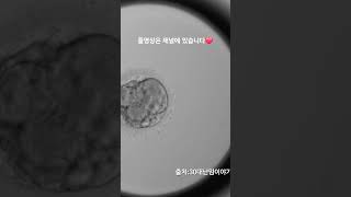 PGT 정상 통과 배아 분열과정 Embryoscope timelapse 시험관 난임 5일배양 통배 pg t염색체 배아분열과정 pgt통과배아 정상배아 [upl. by Bord]