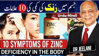 10 Symptoms of Zinc Deficiency in The Body II जिंक की कमी I جسم میں زنک کی کمی کی 10علامات drjeelani [upl. by Andre]