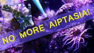 HOW I ELIMINATED AIPTASIA IN MY REEF TANK [upl. by Lertram]