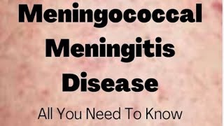 Meningococcal meningitis  social pharmacy 1st year d pharmacy pharmacist biology pharmacy neet [upl. by Einnim]