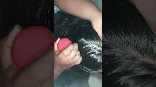 ASMR checking lice and nits 👍 [upl. by Suoiradal]